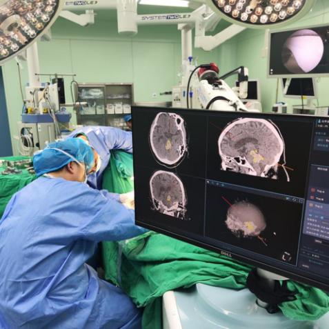 宏粤配资 七旬老人脑干出血深度昏迷！上海医院用机器人辅助可视化技术“精准排险”